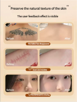 Concealer, a powerful tattoo cover-up tool, effectively conceals scars and invisible patches, specifically designed for flesh-colored spots and acne marks - Image 4